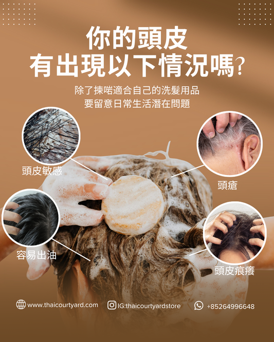 【頭皮救星指南】夏日4大頭皮問題全面解析+5款天然洗髮餅推薦!