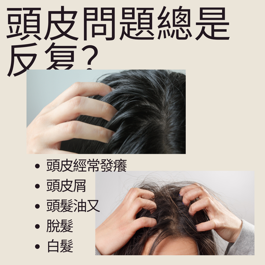《洗髮餅:拯救反复頭皮問題的新利器》