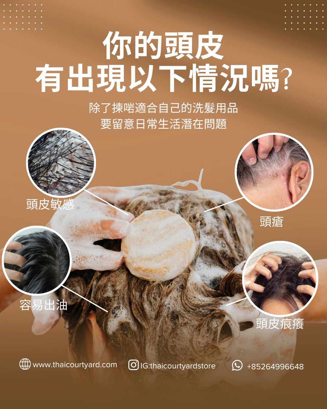 【頭皮救星指南】夏日4大頭皮問題全面解析＋5款天然洗髮餅推薦！